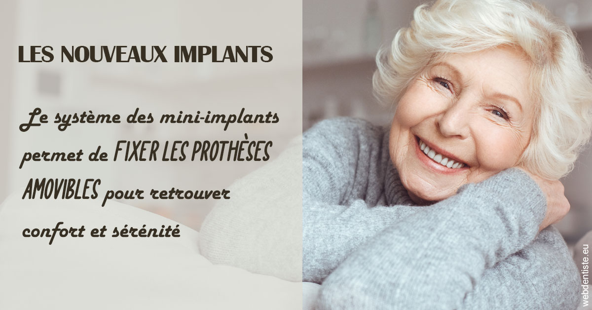 https://dr-veronique-amard.chirurgiens-dentistes.fr/Les nouveaux implants 1