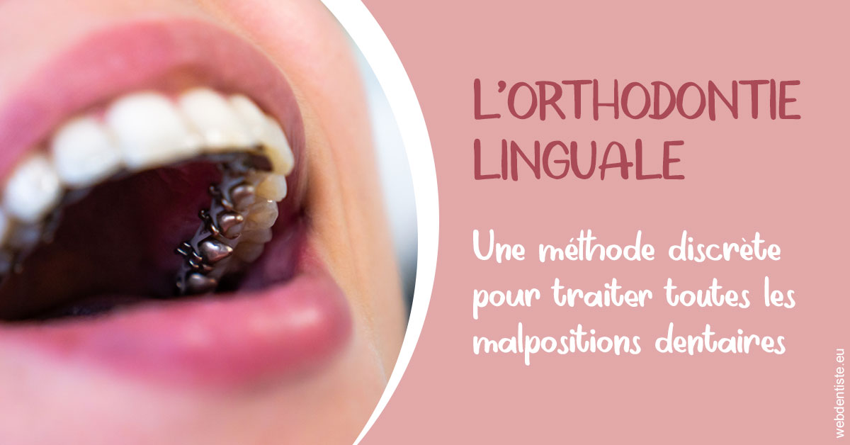 https://dr-veronique-amard.chirurgiens-dentistes.fr/L'orthodontie linguale 2
