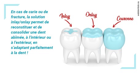 https://dr-veronique-amard.chirurgiens-dentistes.fr/L'INLAY ou l'ONLAY