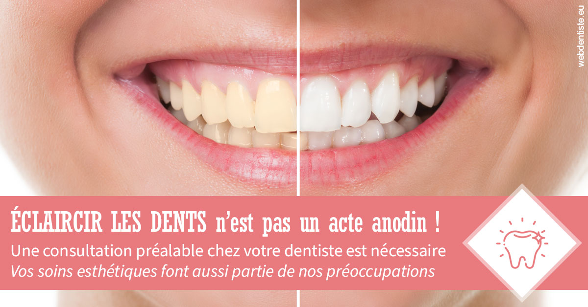 https://dr-veronique-amard.chirurgiens-dentistes.fr/Eclaircir les dents 1
