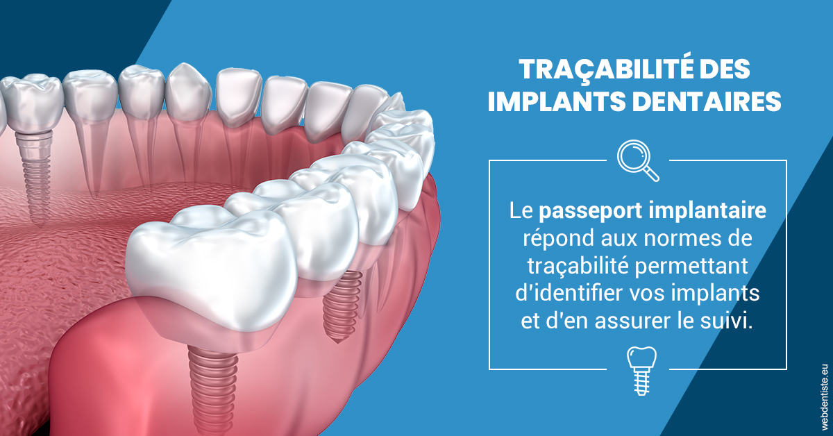 https://dr-veronique-amard.chirurgiens-dentistes.fr/T2 2023 - Traçabilité des implants 1