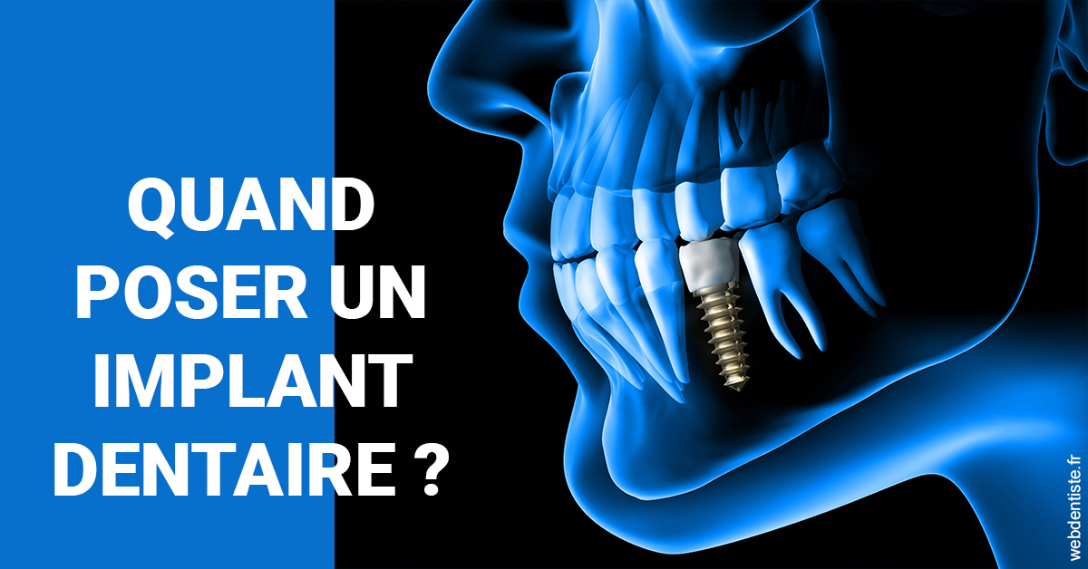 https://dr-veronique-amard.chirurgiens-dentistes.fr/Les implants 1