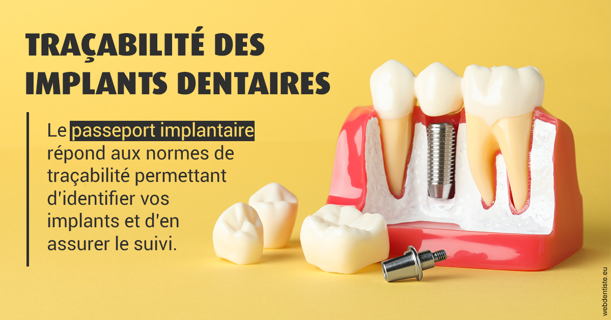 https://dr-veronique-amard.chirurgiens-dentistes.fr/T2 2023 - Traçabilité des implants 2