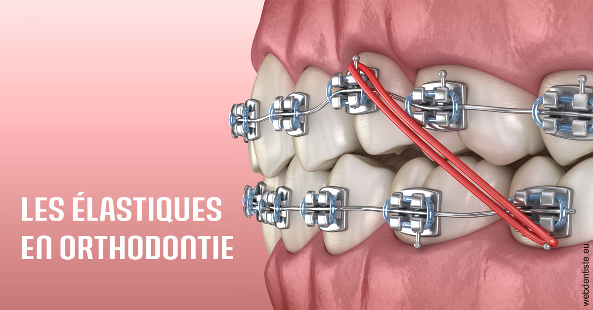 https://dr-veronique-amard.chirurgiens-dentistes.fr/Elastiques orthodontie 2