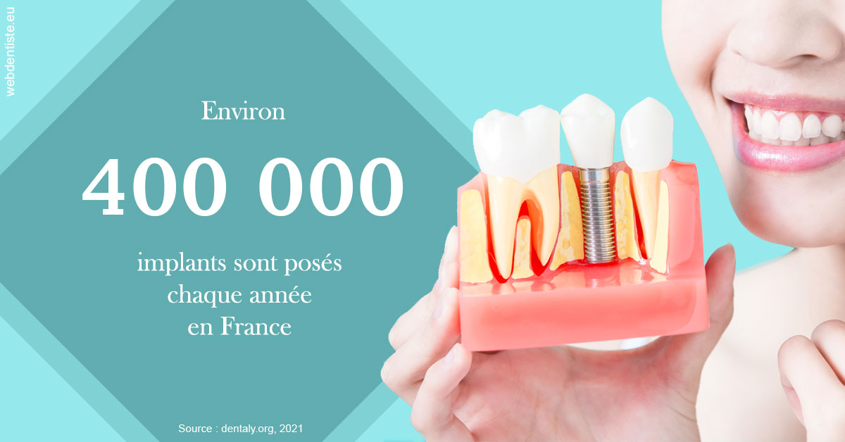 https://dr-veronique-amard.chirurgiens-dentistes.fr/Pose d'implants en France 2