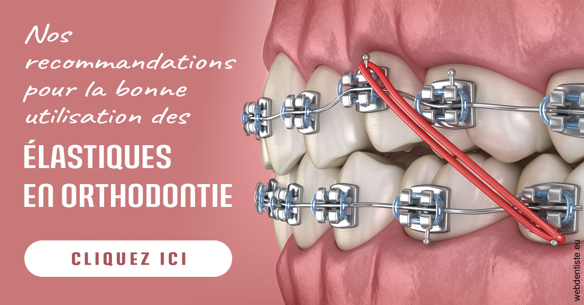 https://dr-veronique-amard.chirurgiens-dentistes.fr/Elastiques orthodontie 2